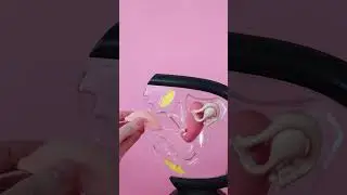 3 разных способа установки менструального диска