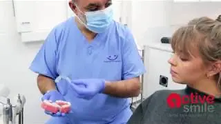 Should I get clear removable aligners or fixed braces?