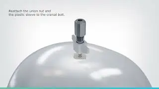 ICP Measurement with Spiegelberg Parenchymal Probe with Bolt (Probe 3PS)