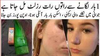 Skin whitening homeremedy by adeela gull