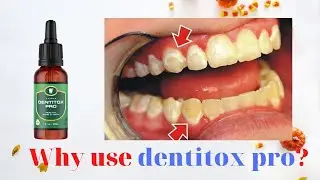 Is It Worth the Money  Scam or Legit |How Is Dentitox Pro Effective |Who Created Dentitox Pro