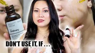 HERE IS WHAT YOU DON'T KNOW ABOUT THE ORDINARY ROSEHIP SEED OIL | Skincare Specialist on Ordinary