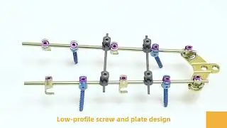 Spine Pedicle Screws | Advanced Spinal Fixation System | Buy at Reviti.co.in