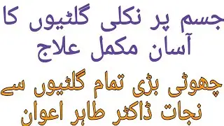 Jisam main gilti ka ilaj in urdu / Hindi | Senay ki gilti ka gharelu ilaj | desi totkay