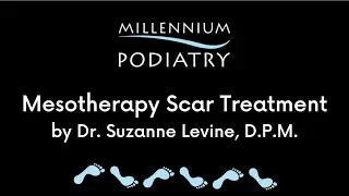 Mesotherapy Scar Treatment by Dr. Levine, D.P.M.