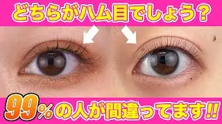実はほとんどの人が間違ってる「ハム目」について解説【二重整形・埋没法】