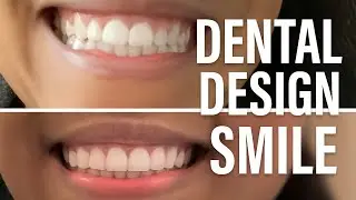 Dental Design Miami