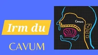 IRM CAVUM -Bonne Pratique_