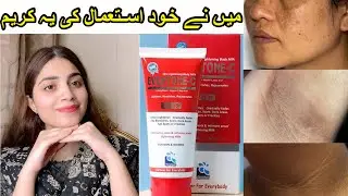 Eventone c cream | How to use | side effects | dr.review in detail | medicated whitening cream