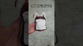 Blood Bag | Anticoagulant : CPDA (Citrate Phosphate Dextrose Adenine)