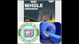 MRI whole abdomen planning and positioning in Philips 3T