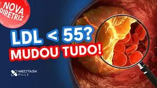 Atualização Dislipidemias 2025: O que mudou e vai cair na prova!