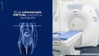 Colonoscopia Virtual - Sabbag Radiólogos