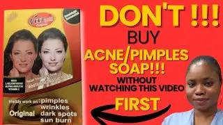 HOW TO USE VEET GOLD FACE SOAP FOR TREATMENT OF PIMPLES/SUNBURN. Why I love veet gold soap