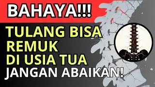 DOKTER KAGET‼️TULANG BISA REMUK TANPA TERASA! LAKUKAN INI AGAR TETAP TEGAK DI USIA TUA!!