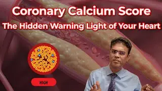 Coronary Calcium Score &ndash; The Hidden Warning Light of Your Heart | DrLogic360