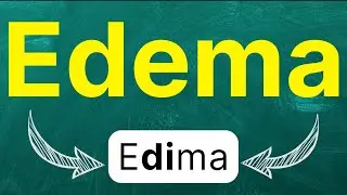How to pronounce: 