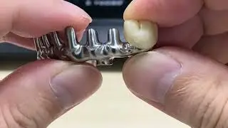 Bridge + Crown Synchronous Design & Milling | Digital Dentistry Innovation | Elosdent桥架+牙冠同步设计&middot;同步加工