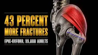 Vegans vs. Carnivores: Surprising Bone Health Study Results!
