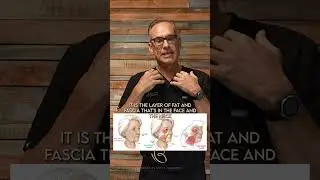 What is a SMAS Facelift?