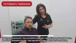 PATIENT'S TESTIMONIAL AFTER FUE HAIR TRANSPLANT | Iplus Hair Transplant Expert