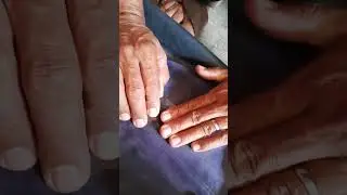 Como fazer remendo de colchão inflável