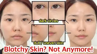Can Vitamin C Really Fade Dark Spots? My Secret Vitamin C Skincare Combo Revealed💛