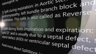 Audio Heart Sound of Split S2 (Split in 2nd Sound) : Real Time Cardiac Sound for Medics & USMLE