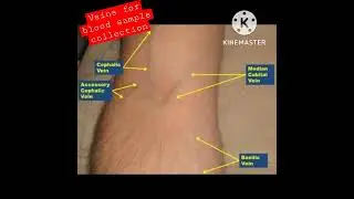 most suitable veins for blood sample collection🥏🥏