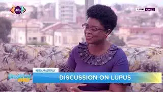 Judith Mills Biomedical Scientist and Disability Advocate Discussion on Lupus