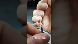 Germs under nails | microscope view of nails Dirt | nail trimmed