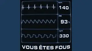 Vous êtes fous