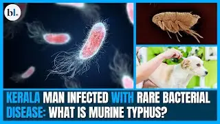 Explained | Kerala man infected with rare bacterial disease: What is Murine Typhus?