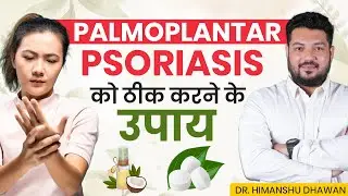 Home remedies to cure Palmoplantar Psoriasis | Best Home Remedy for Palmoplantar Psoriasis