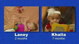 First Look  Vision Screening for Infants