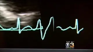 Health: An Important Development For Heart Patients Who Need Pacemakers
