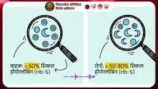Hindi Sickle Cell Song