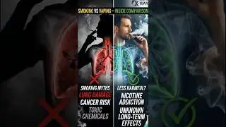 Vape vs Cigarette 🔥 | Real Damage Inside the Body #shorts #education #health