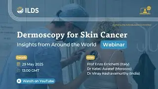 Dermoscopy for Skin Cancer: Insights from Around the World