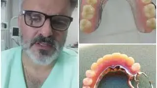 Qual a melhor prótese parcial removível??