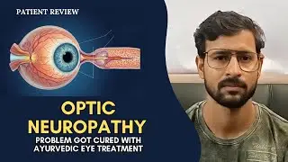 Patient Review | Optic Neuropathy Recovery at OM Ayurveda Eye Care Centre