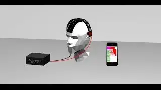 Project : Transcranial Direct Current Stimulation (tDCS)  Device