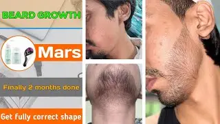 BEARD GROWTH ! Get fully correct shape of beard ! Finally 2 months done ✔️ From mars minoxidil 