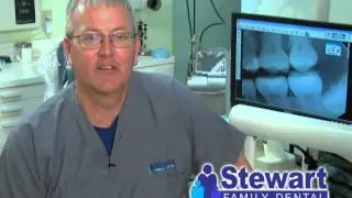 Stewart Family Dental DId You Know Dentures Revised