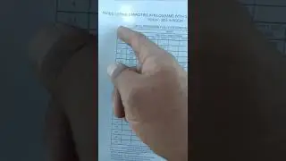 Resúmen Tabla de carga rúa TMS 870