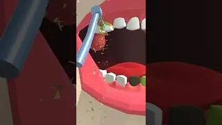 Dentist Care On Tooths Ultimate Cavity Teeths Repair Heeling Animation Satisfying ASMR #cavity #asmr
