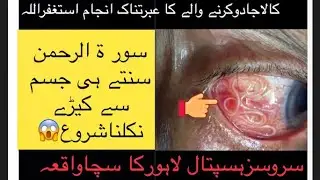 Magician's terrible end in ICU | Dr. Muhammad Javed Sahib ( Services Hospital Lahore ) Must watch