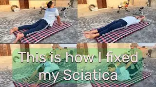 This is how I fixed my Sciatica and lower back pain