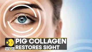 WION Fineprint | Cornea made from pig skin restores sight, minimally invasive treatment