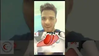 تعمل ايه لو لقيت حد مغمي عليه؟ #سيكوباتي